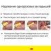 Противошумные одноразовые вкладыши 1100 в пакете для пополнения колбы, 2000 пар/уп